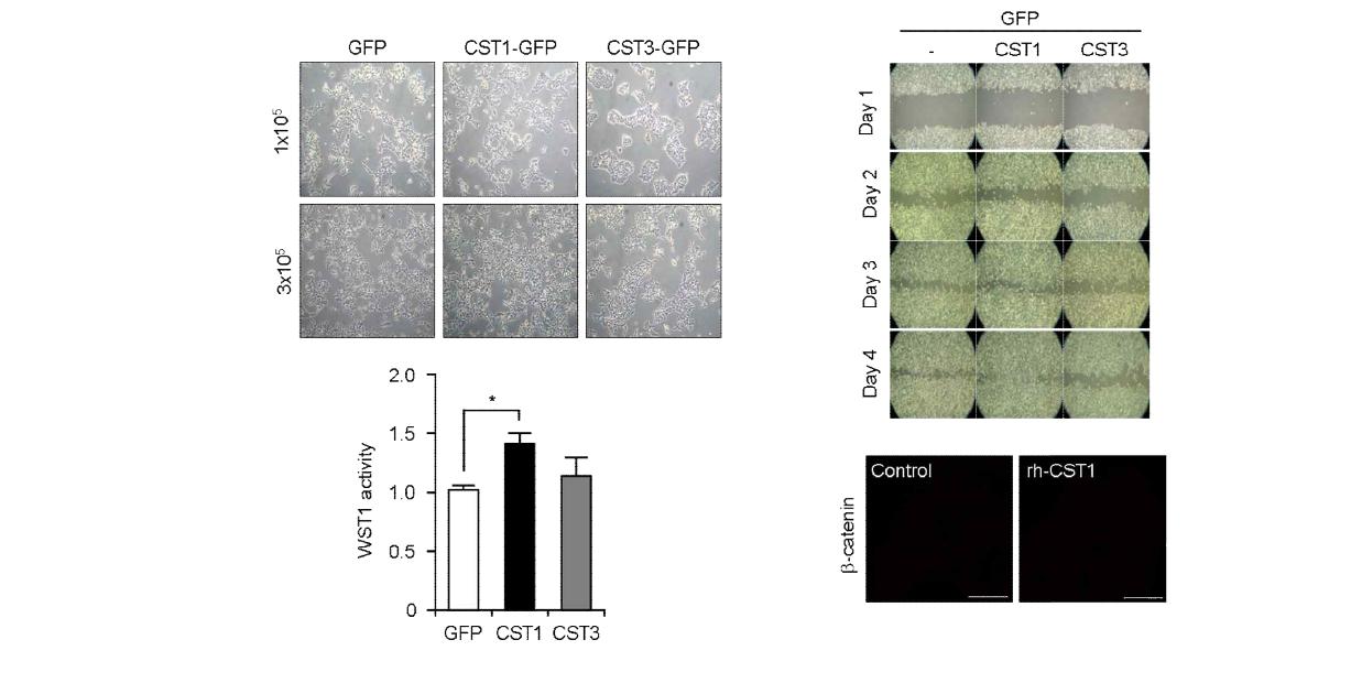 대장암 세포주에서 CST1의 과발현에 따른 암세포 성장, 이동, 전이에 대한 표현형 및 특성 연구