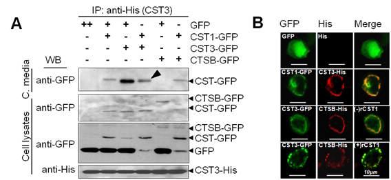 CST1과 CST3의 상호 결합 및 세포내 translocalization의 확인 및 분석