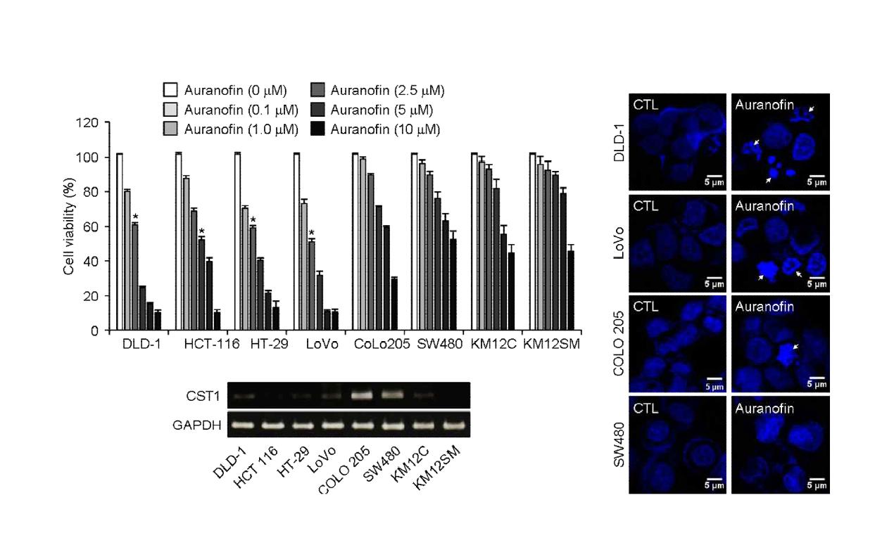 대장암 세포에서 Auranofin에 의한 세포사멸 민감도와 CST1의 발현 패턴 분석