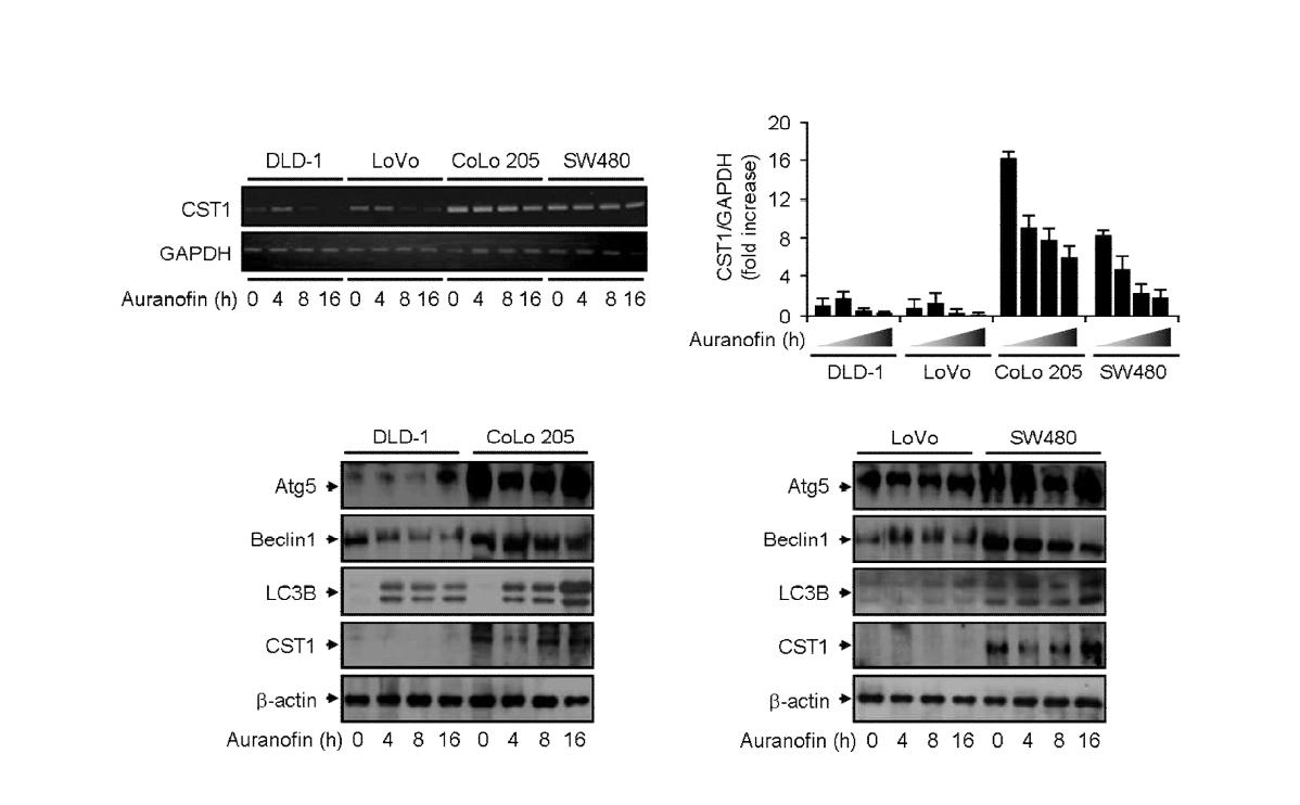 대장암 세포에서 Auranofin에 의한 세포사멸 유도시 CST1과 오토페이지와의 조절 패턴 분석