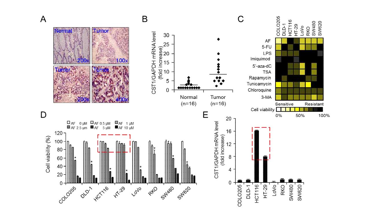 대장암 조직 및 세포주에서 cystatin SN (CST1)의 발현, 항암제의 민감도 및 세포사멸 검증