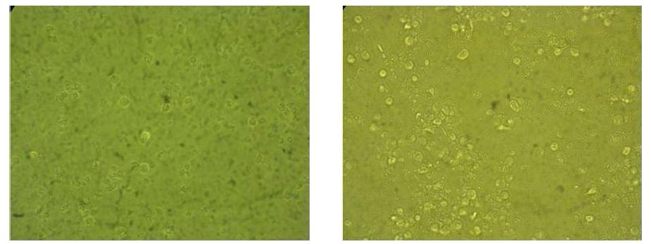 Cytopathic effects of H9N2 influenza virus isolates on MDCK cells with or without trypsin