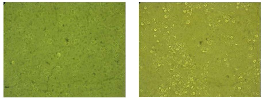 Cytopathic effects of H9N2 influenza virus isolates on MDCK cells with or without trypsin