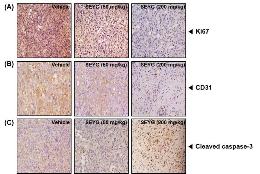 (A) Immunohistochemical analysis of proliferation marker Ki-67+ cell indicates the inhibition of human prostate cancer cells proliferation by SEYG dose-dependent treated groups of animals
