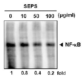 SEPS inhibits constitutive NF-kB activation in breast cancer cells