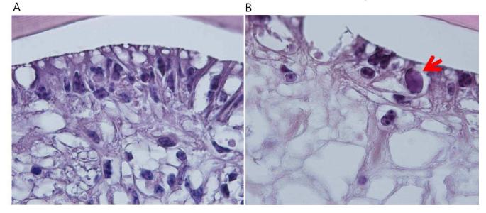 Histological change at cuticular epithelial cells after WSSV infection.