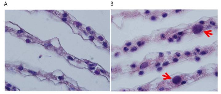 Morphology changes at gill M. nipponense after WSSV infection