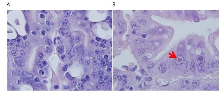 Morphology changes at hepatopancreas M. nipponense after WSSV infection.