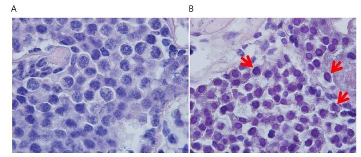 Morphology changes at testicle M. nipponense after WSSV infection.