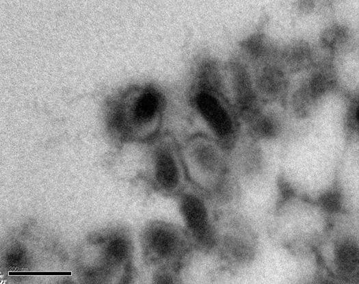 Transmission electronic microscopy observation showing WSSV virions.