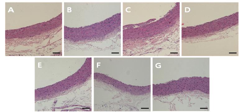 Acanthopanax 추출물 첨가가 14 주간 콜레스테롤 식이를 섭취한 SHR 군의 대동맥에서 조직학적 변화에 미치는 영향(Hematoxylin/eosin staining; original magnification X 200)
