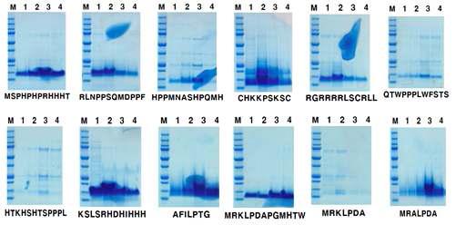 친화성 크로마토그래피를 이용한 실리콘 특이적 항체결합단백질 분리/정제