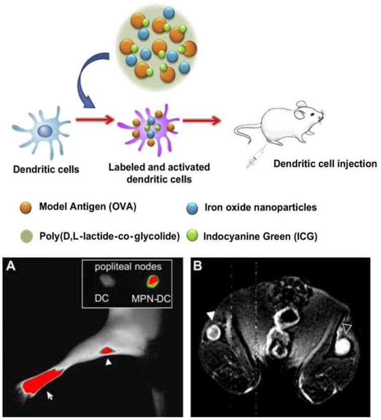 NIR 과 MR 조영제를 포함한 고분자 나노입자(위)와 이를 탐지한 면역세포의 이동을 관찰하는 사진(아래)