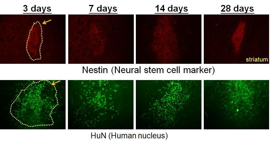 도파민성 신경세포사가 일어난 쪽의 striatum지역으로 neural stem cell을 주입한 후 3일, 7일, 14일, 28일에 neural stem cell 마커인 nestin과 human-stem cell marker인 HuN 항체를 이용하여 면역염색 하여 뇌지역에서 stem cell의 유지와 위치를 확인