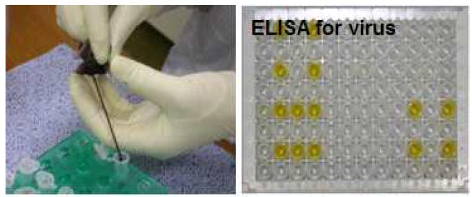 미생물에 대한 항체 ELISA를 이용한 혈청학적 검사