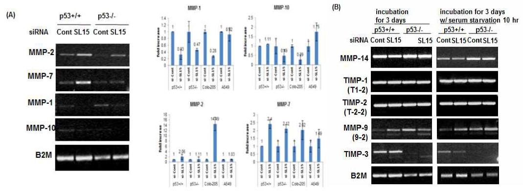 SL-15 저해에 의한 암 세포주에서의 MMPs/TIMPs 발현 및 활성 분석