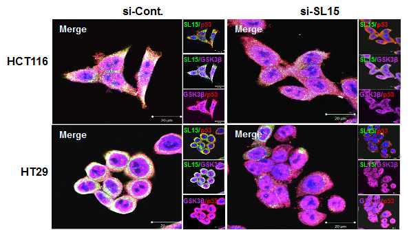 대장암 세포주 HCT116, HT29 세포주에서 SL-15와 상호작용 단백질 동정