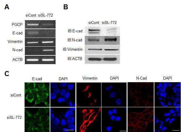 SL-772 knockdown에 의한 EMT/MET 마커의 변화