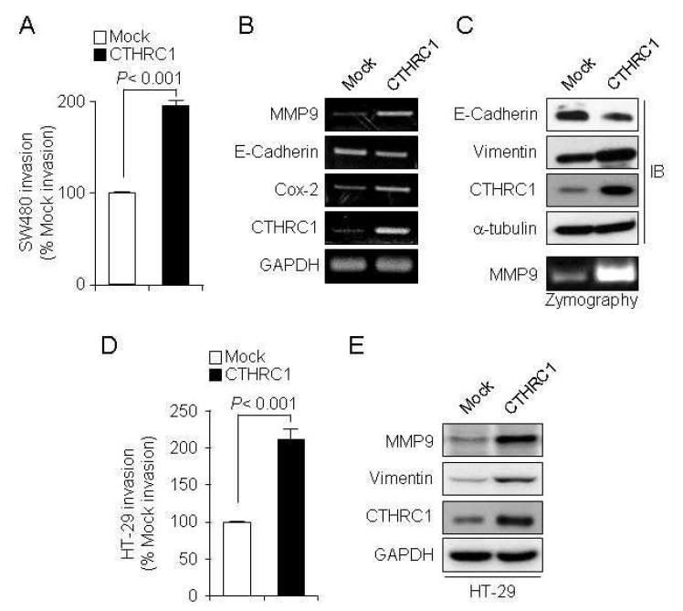 MMP9에 의한 암세포 전이의 Cthrc1의 관련 규명 및 작용기작 연구