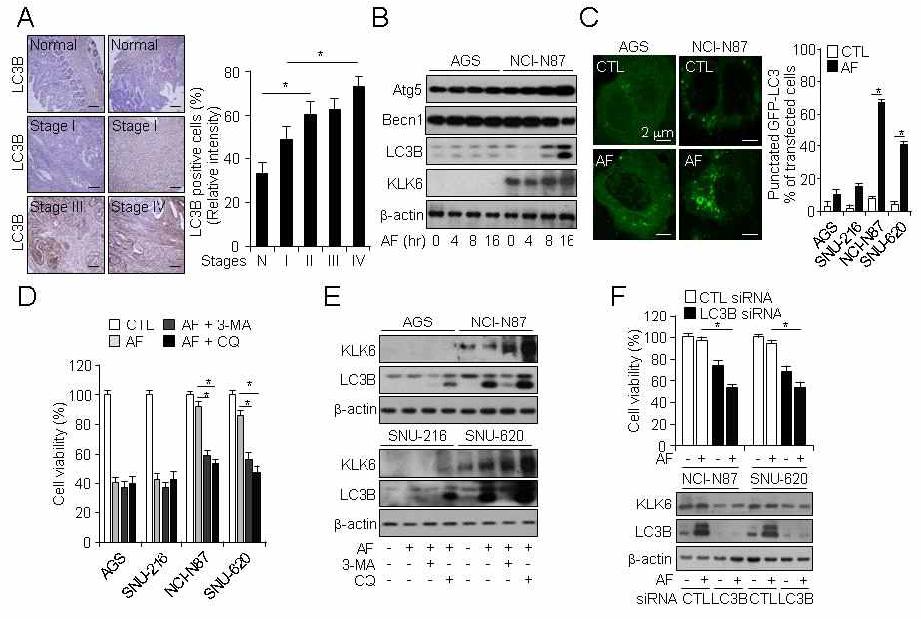 대장암 세포주에서 KLK6 발현에 따른 항암제 유도의 오토페이지 조절 분석