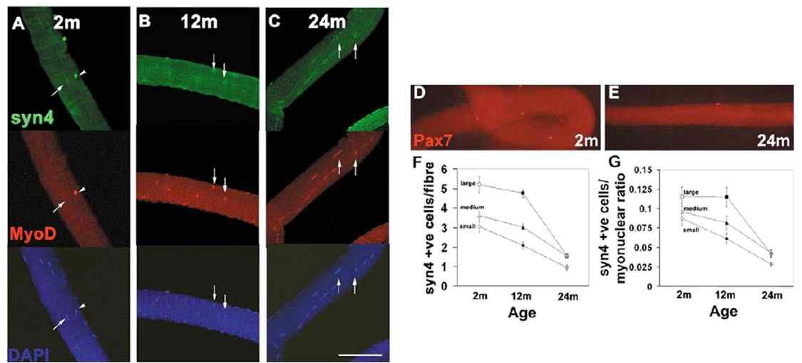 노화에 따른 감소된 Syn4+ Satellite cell