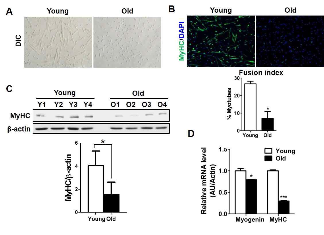 young & old myoblast의 분화능 비교