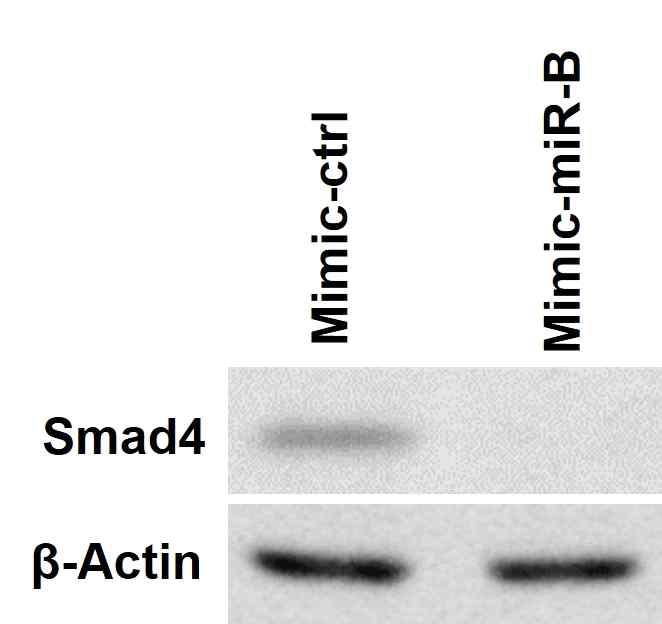 miR-B 과발현 old myoblast에서 저하된 Smad4 단백질 발현