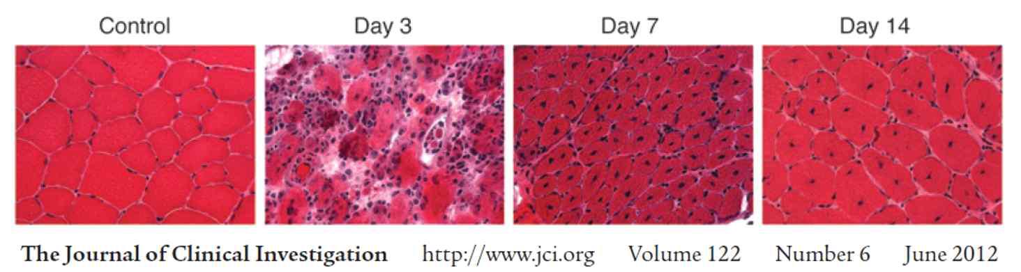 CTX를 활용한 근육재생 마우스 모델