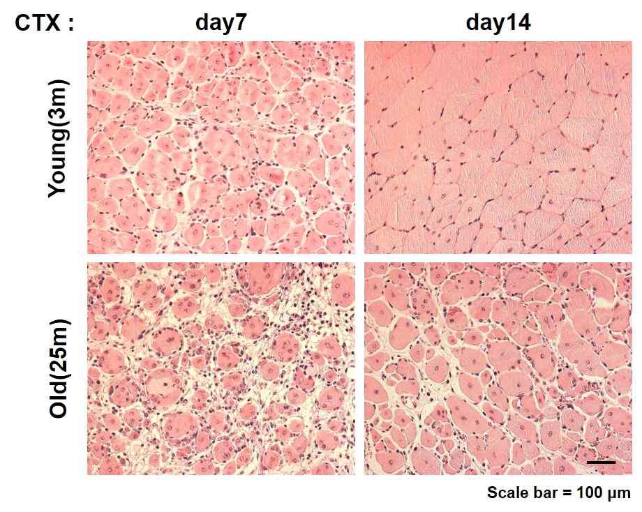 CTX 손상에 따른 young, old mouse 근육의 재생능 비교