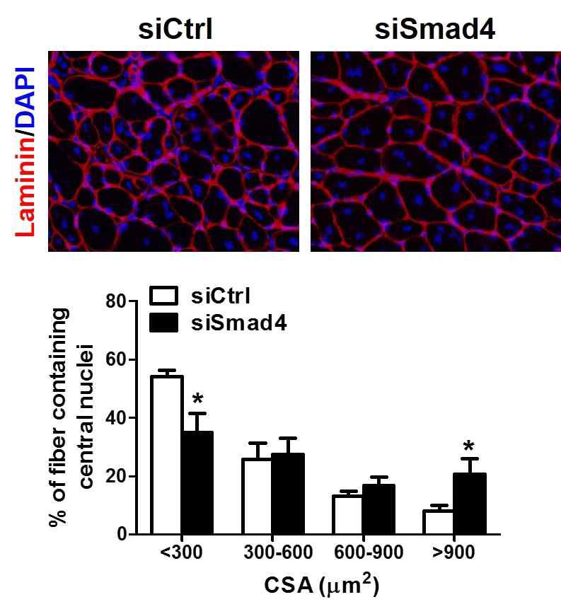 siSmad4 에 의한 노화 근육의 재생 회복 확인