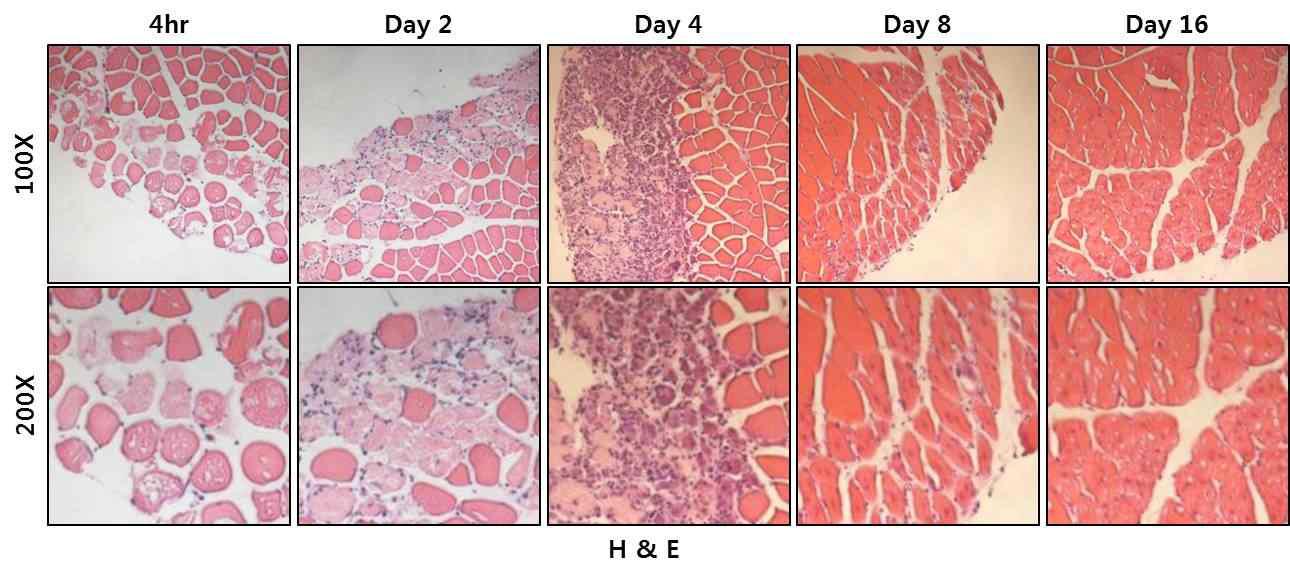 근육 손상 모델에서 손상된 근육과 재생되는 근육의 조직 단면