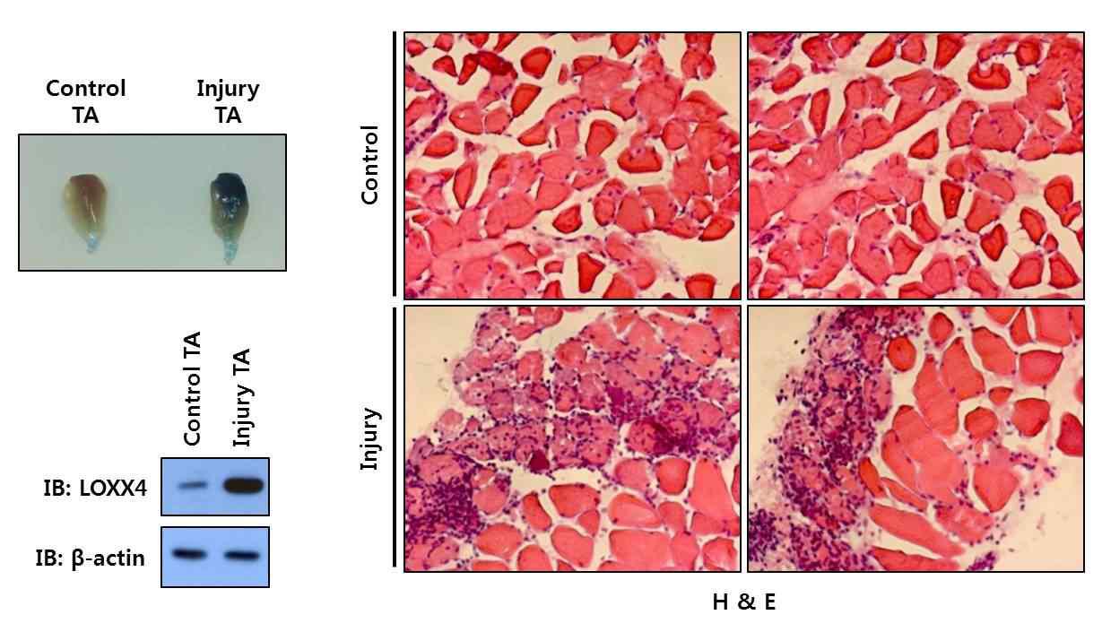 근육 손상에 의한 LOXX4의 단백질 발현 증가