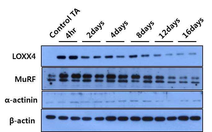 근육 손상 후 재생되는 동안 선별된 1종 유전자, LOXX4의 단백질 발현 양상