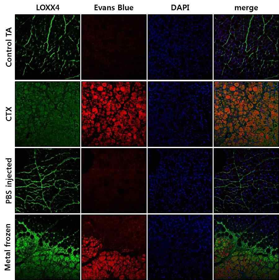 손상된 근육다발 안에서 LOXX4 단백질 발현 증가
