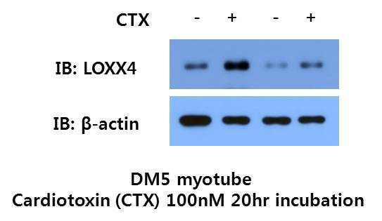 배양된 myotube 에서 cardiotoxin 처리에 의한 LOXX4 단백질 발현 증가