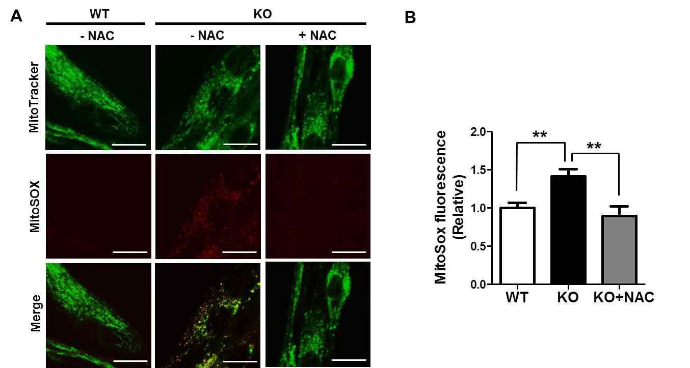 MitoSOX를 이용하여 ROS측정하였을 때, Prx3 KO myotube에서 더 높은 ROS를 확인함