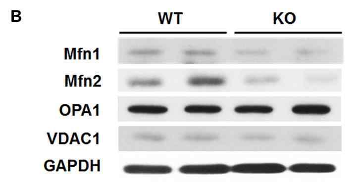 Prx3 KO Soleus 근육조직에서 mitochondria fusion-fission 관련 단백질 확인