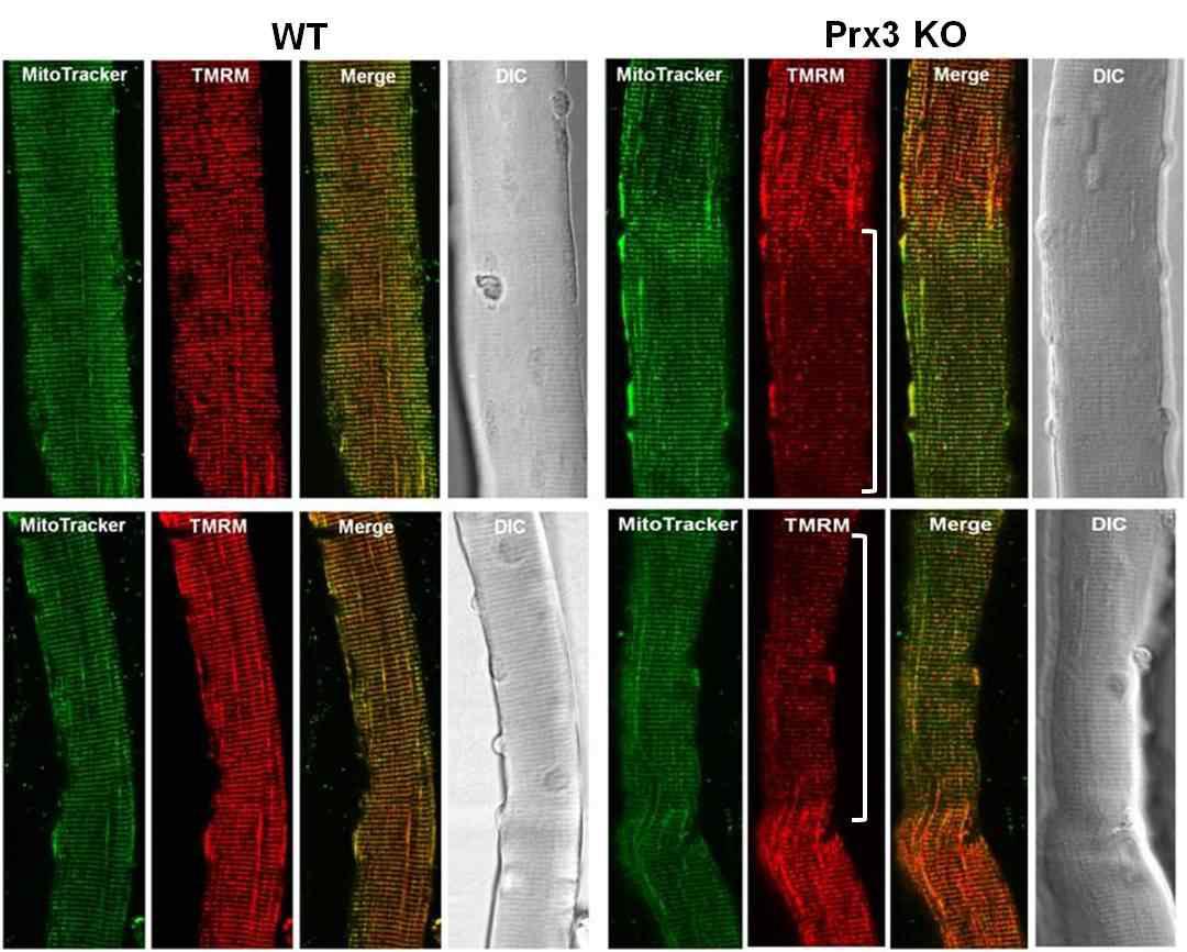 Prx3 KO FDB muscle fiber의 감소된 미토콘드리아 활성도