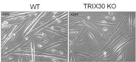 TRIX30-/- primary myoblast cell 에서의 분화 저해