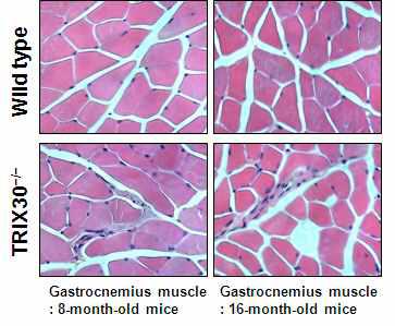 H&E 염색법으로 확인한 TRIX30-/- 마우스 근육 다발