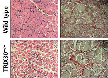 근육 재생능이 감소된 TRIX30-/- 마우스 근육
