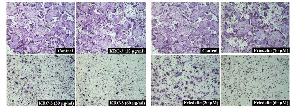 KRC-3 및 분리된 활성물질 Friedelin의 파골세포 분화, 형성 억제 효과