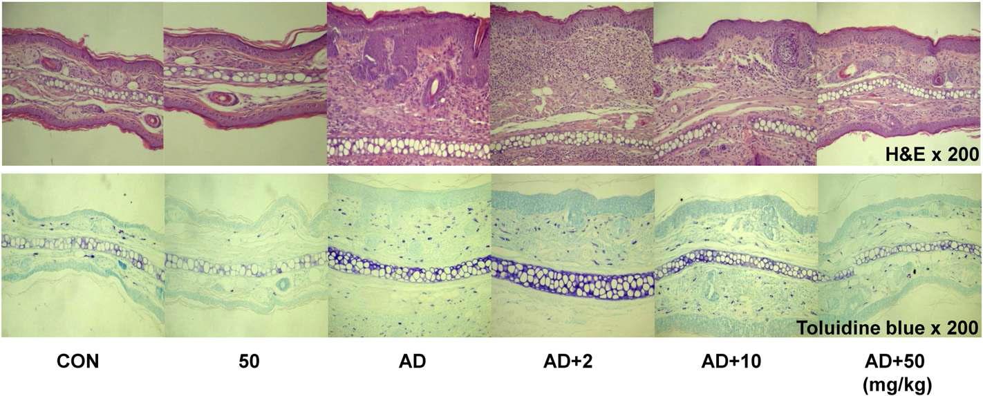 KR-301에 의한 아토피성 피부염 완화의 조직학적 관찰