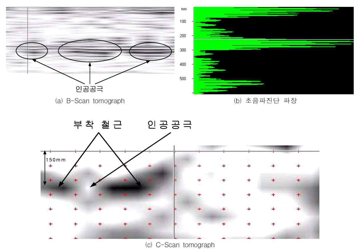 초음파 진단 결과