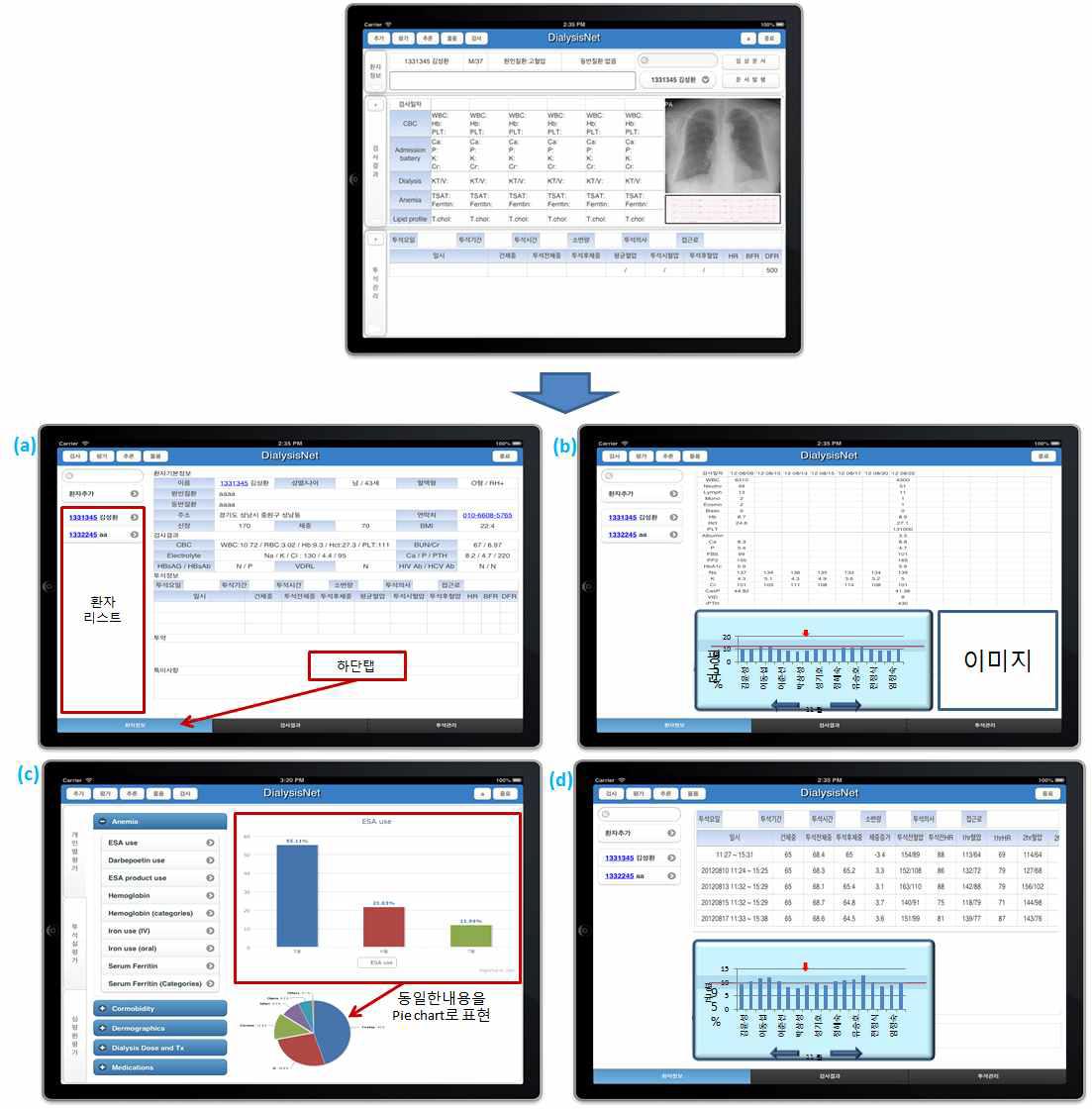 상위의 DialysisNet UI가 1차년도 기개발된 시스템이 하위의 4가지 UI로 변경되었음. (a) 환자리스트와 하단에 메인 3개 기능을 포함한 DialysisNet의 메인 UI로써 환자정보가 모임, (b) 검사결과 UI로써 각 검사항목을 클릭하면 검사결과 값이 그래프로 나타나고, 빨간색으로 해당 기관의 검사결과 평균값이 나타남, ( c) 진료 외의 기능인 평가와 추론 중 평가에 대한 그래프 하단탭 대신 좌측의 탭으로 개인별평가, 투석실평가, 심평원평가 결과를 볼 수 있음, (d) 투석관리 UI로써 최근 5번의 투석정보가 상위 표를 통해 보이고 검사결과와 동일하게 투석수치의 변화량을 그래프로 볼 수 있음.