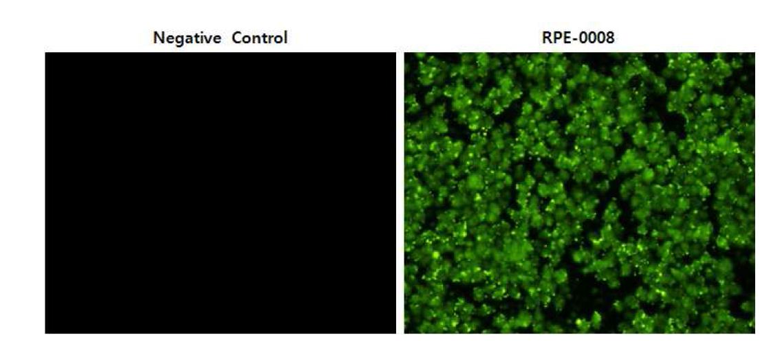 hRPE 세포의 식균작용 결과