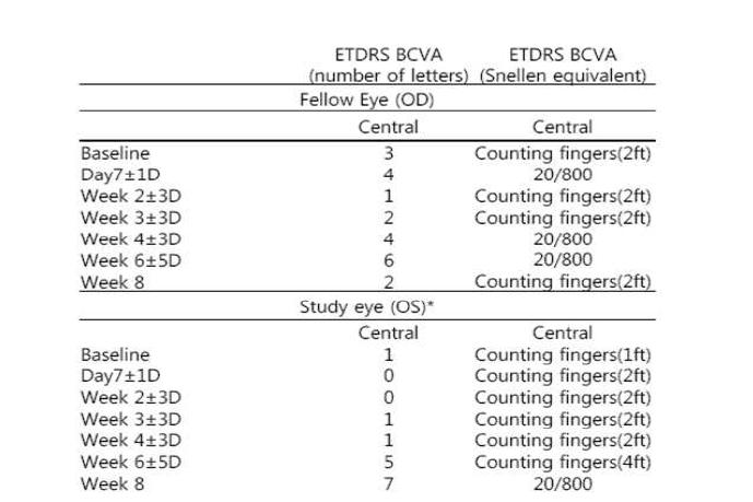 ETDRS 시력검사