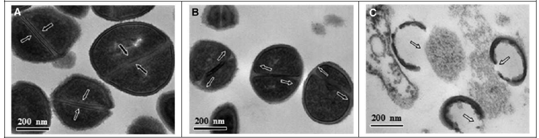 Transmission electron microscopy images of methicillin-resistant Staphylococcus aureus (MRSA) after 24 h of Sophoraflavanone B (SPF-B) treatment. (A) Untreated control MRSA. These arrows show intact septa. (B) MRSA treated with half the minimum inhibitory concentration (MIC) of SPF-B (7.8 lg/mL). These arrows indicate damage to the cell membrane caused by the antimicrobial activity of SPF-B. (C) MRSA treated with the MIC of SPF-B (15.6 LG/ mL). These arrows show cell division and the leakage of the cytoplasmic contents of the MRSA strains from the cell.