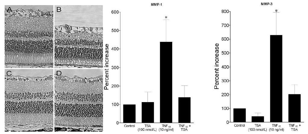 허혈성 안구 rat model의 TSA 효과 (좌 : 망막 단면도, A,B:vehicle, C,D: TSA 처리, 우 : 시신경 성상세포 MMP 효소 발현 정도)