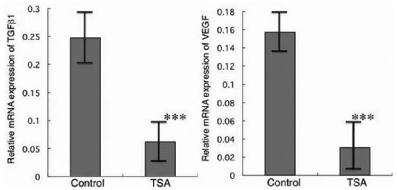 TSA에 의한 대식세포 내 TGFβ1, VEGF 발현 억제 효과(10 nM TSA, 24h)